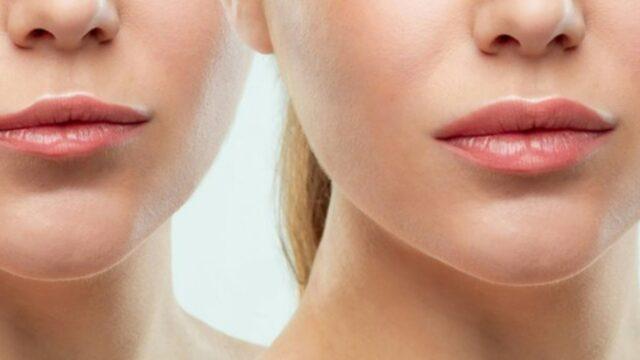 Hiç aklımıza gelmemiş: Evde en kolay dudak büyütme yöntemi! Dudak dolgunlaştırmak için...
