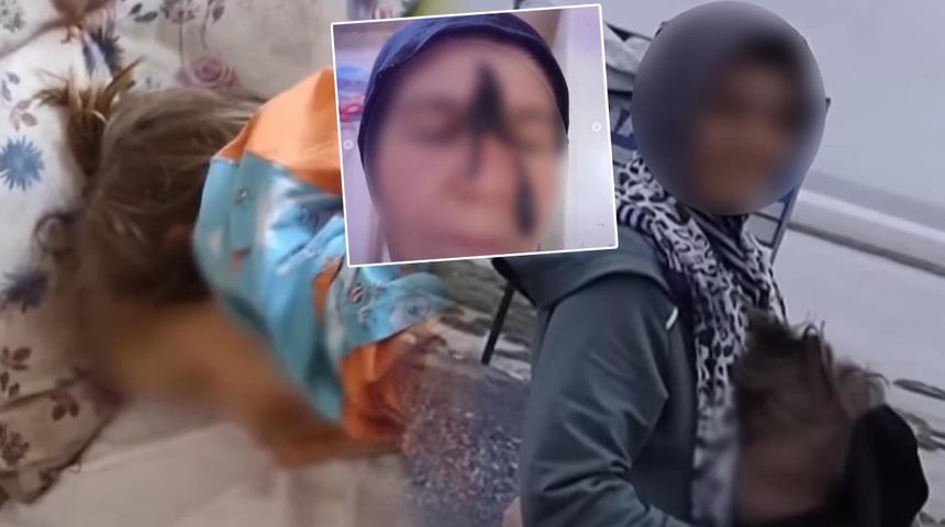 Gözlerinin önünde sürekli kusuyor ama… Sosyal medya o anneyle çalkalanıyor! ‘Bu çocuğu kurtarın’ Çocuğunu 36 saat aç bırakıyor