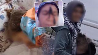 Gözlerinin önünde sürekli kusuyor ama… Sosyal medya o anneyle çalkalanıyor! ‘Bu çocuğu kurtarın’ Çocuğunu 36 saat aç bırakıyor