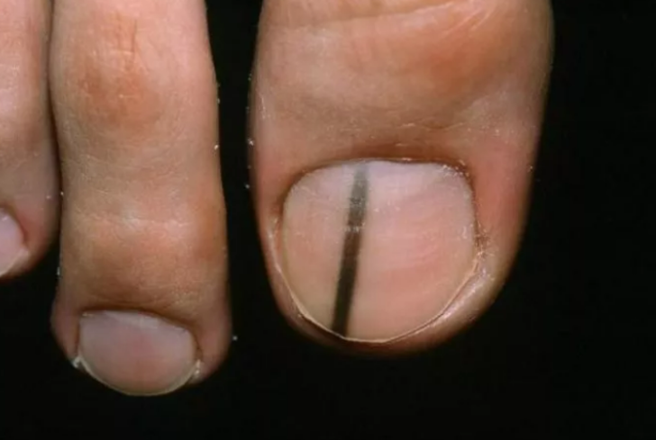 Bugüne kadar hiç duymamıştık: Kanserin şaşırtan belirtileri! Gördüğünüz an doktora başvurun...  G3