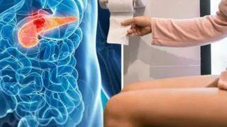 Bugüne kadar hiç duymamıştık: Kanserin şaşırtan belirtileri! Gördüğünüz an doktora başvurun... 