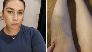 Bacaklarını almıyor ve yıkanmıyor! 2023'te 9 bin TL tasarruf etti...Koksam bile umurumda değil