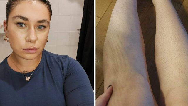 Bacaklarını almıyor ve yıkanmıyor! 2023'te 9 bin TL tasarruf etti...Koksam bile umurumda değil