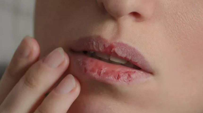 Önemsiz görülüyor ama ciddi hastalıkları habercisi olabilir! Ağız kuruluğu önceden uyarı veriyor
