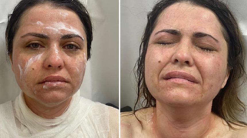 Sokak ortasında kimyasal maddeli saldırı kamerada! 'Güzelliğine mi güveniyorsun?'