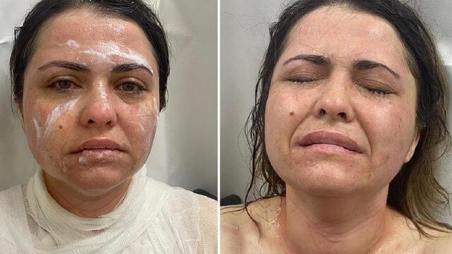 Sokak ortasında kimyasal maddeli saldırı kamerada! 'Güzelliğine mi güveniyorsun?'