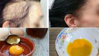 Sadece 3 malzemeyle dökülen saçlarınızı geri kazanın! Resmen saç fışkırtıyor