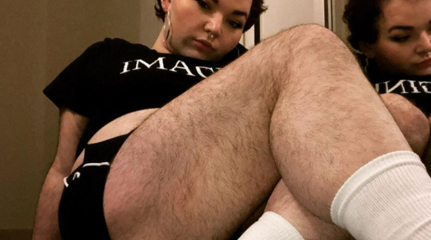 Gen&ccedil; kadın v&uuml;cudundaki t&uuml;yler nedeniyle ağır yorumlara maruz kaldı! Her şey 8 yaşında başladı...