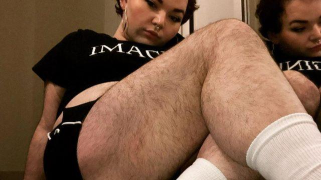 Genç kadın vücudundaki tüyler nedeniyle ağır yorumlara maruz kaldı! Her şey 8 yaşında başladı...