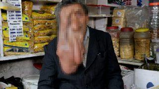 Hastalığı nedeniyle yüzü zamanla erimeye başladı! Özgürce hareket edemiyorum