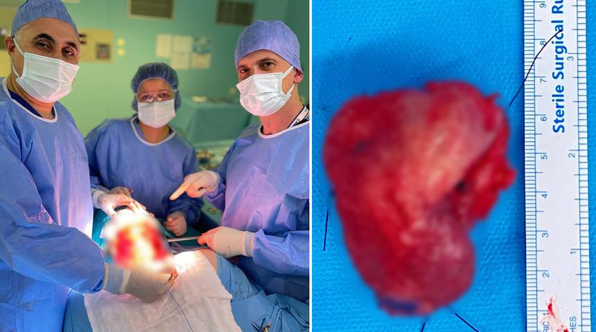 Doktordan korkup hastaneye gitmedi, kırık dişi yüzünden dil kanseri oldu! 