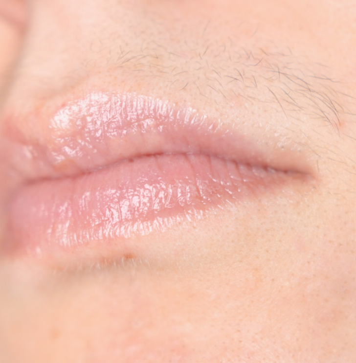 Her kadının bilmesi gerekiyor: Günlük problemleri çözen basit tüyolar! Çilek bacaklara ve kararmış koltuk altlarına veda edin G1