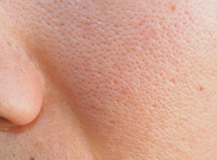 Her kadının bilmesi gerekiyor: Günlük problemleri çözen basit tüyolar! Çilek bacaklara ve kararmış koltuk altlarına veda edin G3