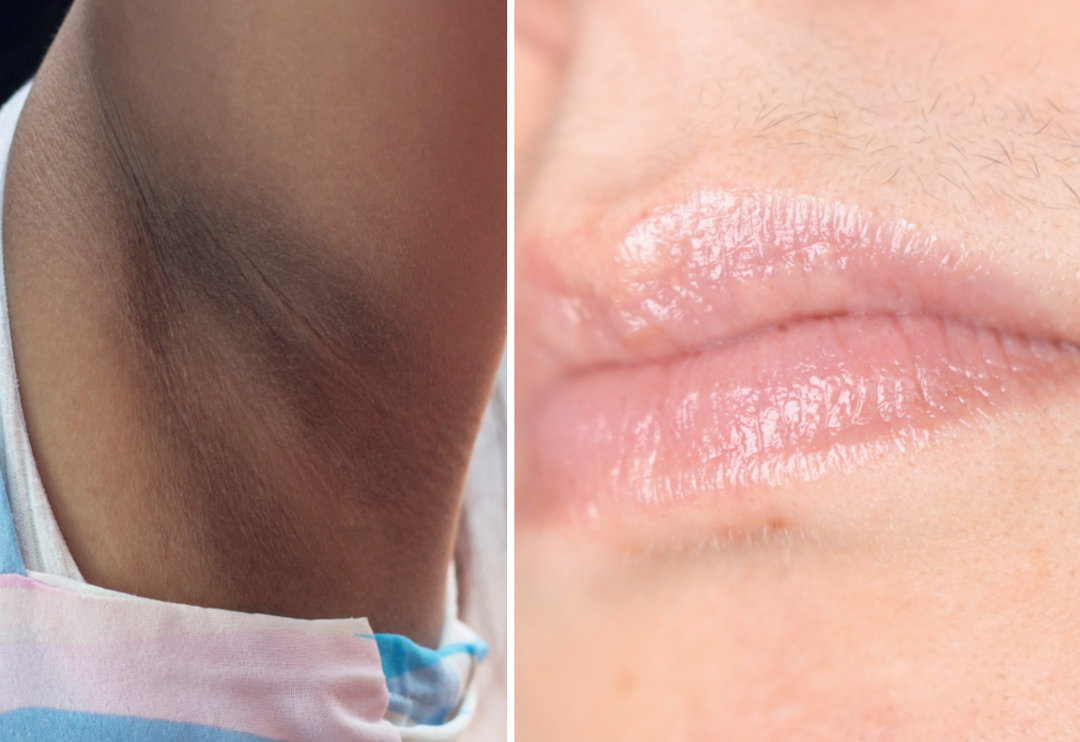 Her kadının bilmesi gerekiyor: G&uuml;nl&uuml;k problemleri &ccedil;&ouml;zen basit t&uuml;yolar! &Ccedil;ilek bacaklara ve kararmış koltuk altlarına veda edin