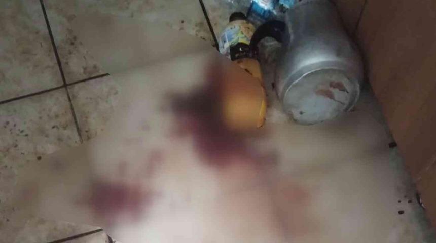 "Dükkandaki her şeyle benim kafama vurdular" Ortalığı kan gölüne çevirdi: Amcasının kafa derisini yüzdü! Miras kalan araba...