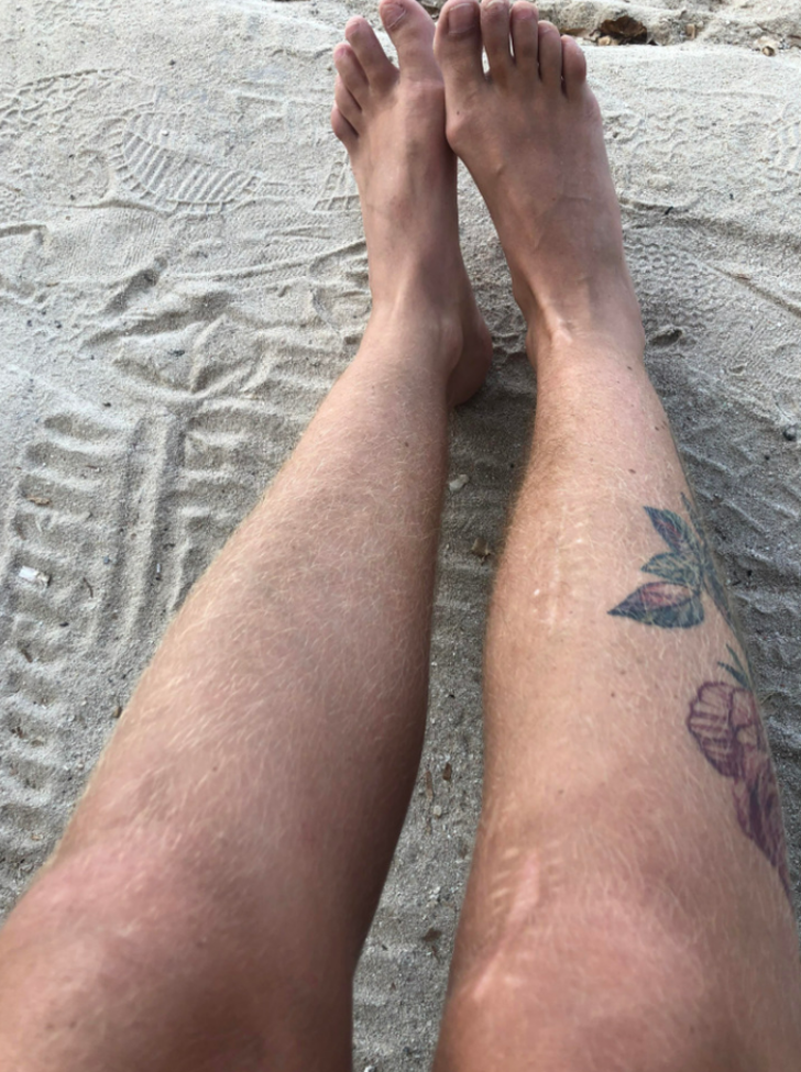 “Kıllı plaj bacaklarımdan memnunum”