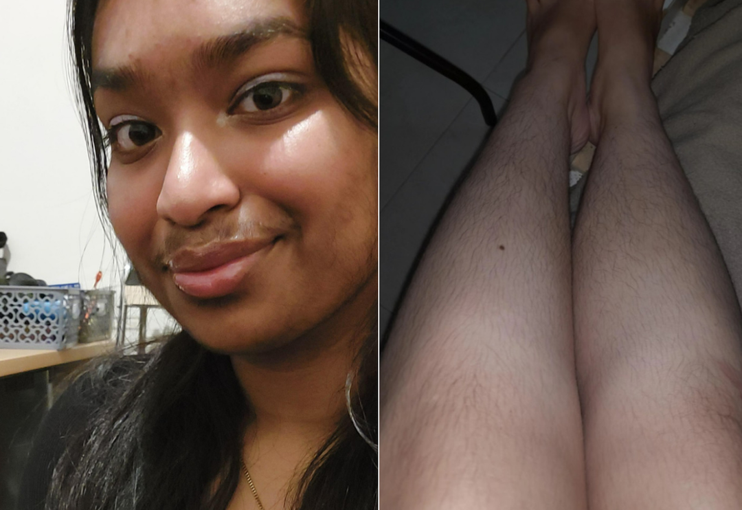 İstenmeyen t&uuml;ylerini almayı bırakarak v&uuml;cudunu sergileyen 16 cesur kadın