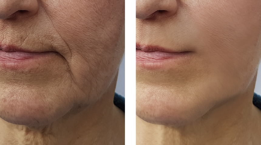 Bu hatayı sakın yapmayın: Yaşınıza yıllar katıyor! 10 yaş büyük gözükmenize neden oluyor