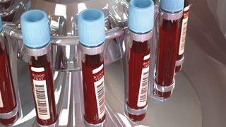 Bu kan grubuna sahipseniz en zeki sizsiniz! Kan grubunuza göre kişilik özellikleriniz