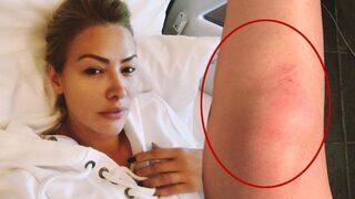 Aylin Coşkun, klip çekiminde kaza geçirdi