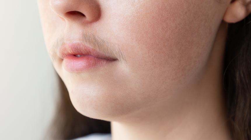 İstenmeyen tüylerden acısız kurtulmanızı sağlayacak doğal çözümler