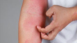 Dikkat! Türkiye'de sayı giderek artıyor... Belirti göstermeden hızlıca bulaşıyor!