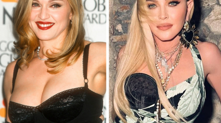 64 yaşındaki Madonna'nın cildini sıkılaştırma sırrı! Sadece çatal kullanarak...