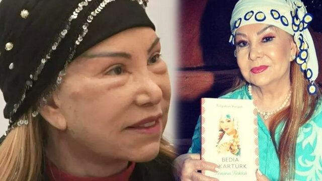 81 yaşında estetik yaptıran Bedia Akartürk eleştirilere yanıt verdi! ''Gelsinler 80 yaşında, çıksınlar 15 yaşında...''