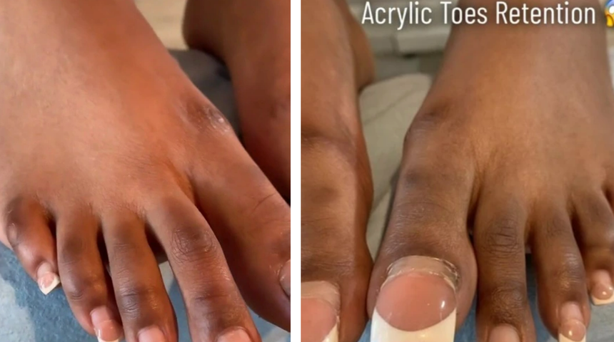 Tırnaklarını aylardır kesmeyen kadın sosyal medyada g&uuml;ndem oldu