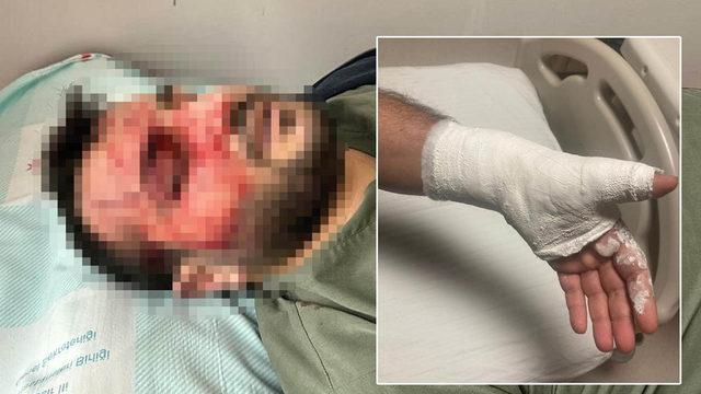 Ameliyattan çıkıp... 'Beni kanlar içinde bırakıp gittiler' Hastanede doktorların kavgası! 'Hocanı da seni de...'