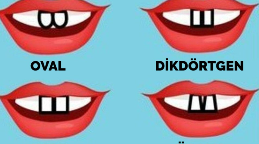 &Ouml;n dişleriniz karakter &ouml;zelliklerinizi belirliyor! Diş şeklinize g&ouml;re nasıl birisiniz?