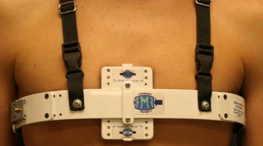 Güvercin göğsü tedavisinde yeni yöntem 