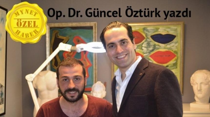 Saç ekimi öncesi dikkat edilmesi gerekenler