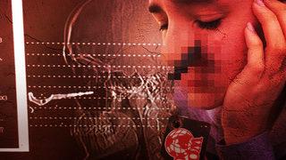 Araba anahtarı gözünün birkaç santimetre altına saplandı! “Neredeyse kör olacaktım”