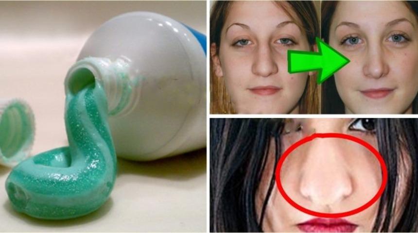 Yurt dışında popüler oldu: Diş macunu ile burun küçültme nasıl yapılır?