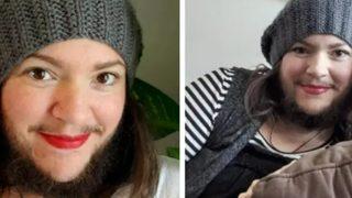 Sakallarını almayı bırakarak vücuduyla barıştı! Yıllarca zorbalığa uğramıştı...