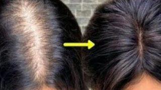 Sadece 2 malzeme ile dökülen saçlarınızı geri getirin! Saçlarınızı gürleştirecek maske tarifi