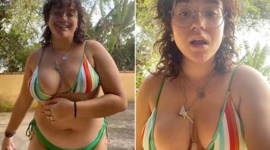 Bir göğsü diğerinden daha büyük olan sosyal medya fenomeni eleştirilere isyan etti! “Bu normal!”