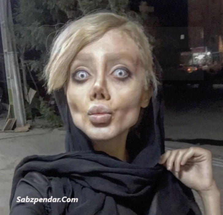 Angelina Jolie�ye benzemek isteyen kızın son hali korkunç!