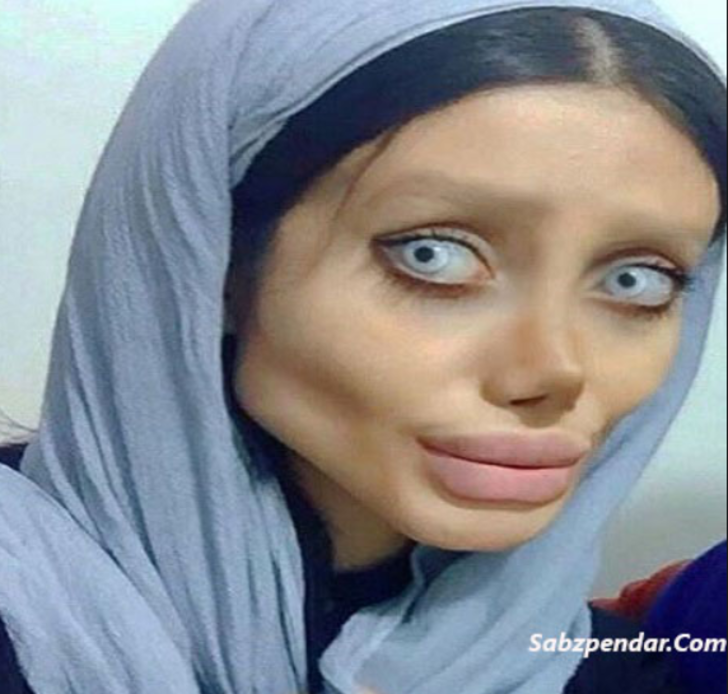 Angelina Jolie�ye benzemek isteyen kızın son hali korkunç!