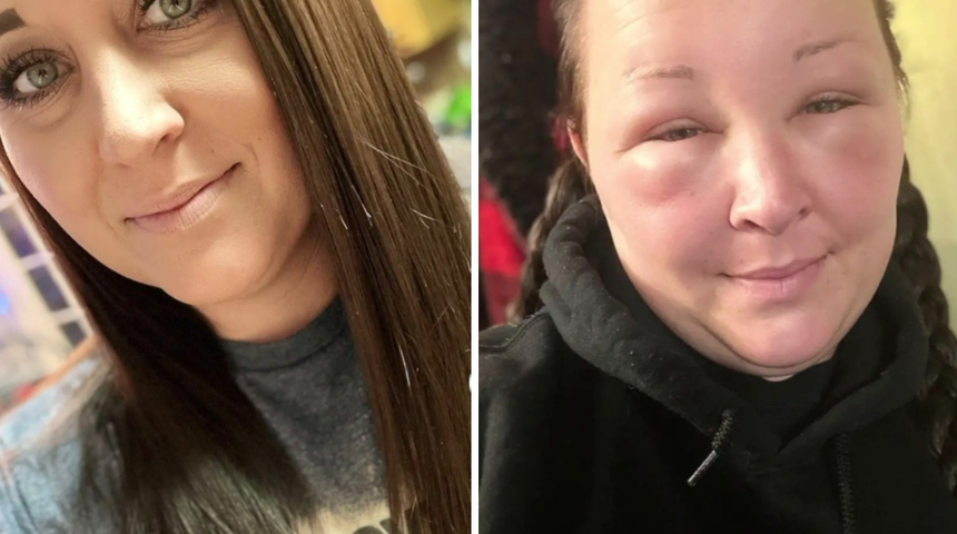 Saçınızı boyatmadan önce tekrar düşünün! Saç boyasının etkileri dehşete düşürdü