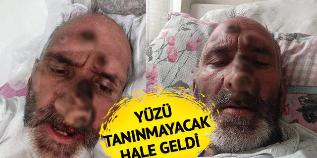 'Gece siz uyurken...' Çalışmak için Antalya'ya gitti hayatı karardı