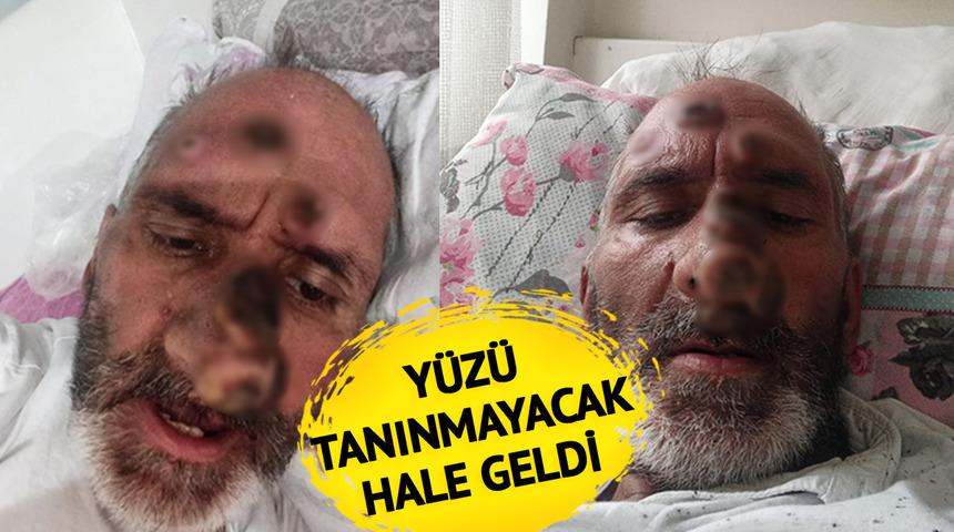 'Siz uyurken çıplak alanlarınızı ısırarak...' Çalışmak için Antalya'ya gitti hayatı karardı! Her şey bir ısırıkla oldu
