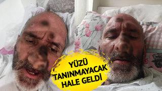 'Siz uyurken çıplak alanlarınızı ısırarak...' Çalışmak için Antalya'ya gitti hayatı karardı! Her şey bir ısırıkla oldu