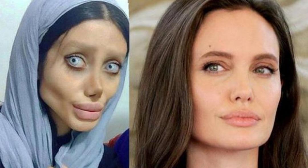 Angelina Jolie'ye benzemek isteyen kızın son hali korkun&ccedil;! 