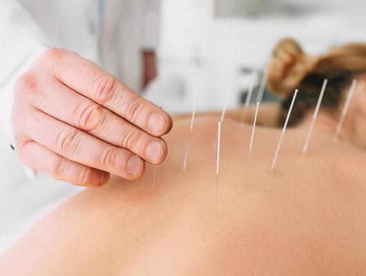 Akupunktur ile zayıflama mümkün mü?