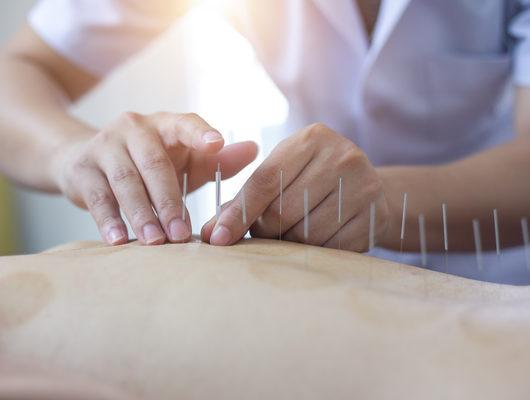 Ağrılara iyi gelen akupunktur noktaları nedir?