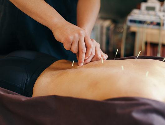 Boyun ve bel ağrısına akupunktur nasıl yapılır? 