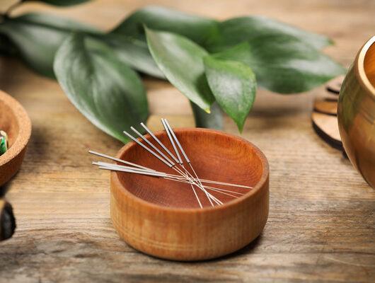Akupunktur iğnesi nedir, ne işe yarar? 