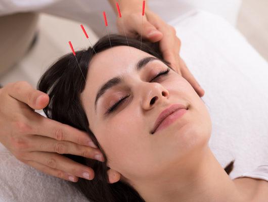 Kozmetik akupunktur cildi gençleştirir mi?